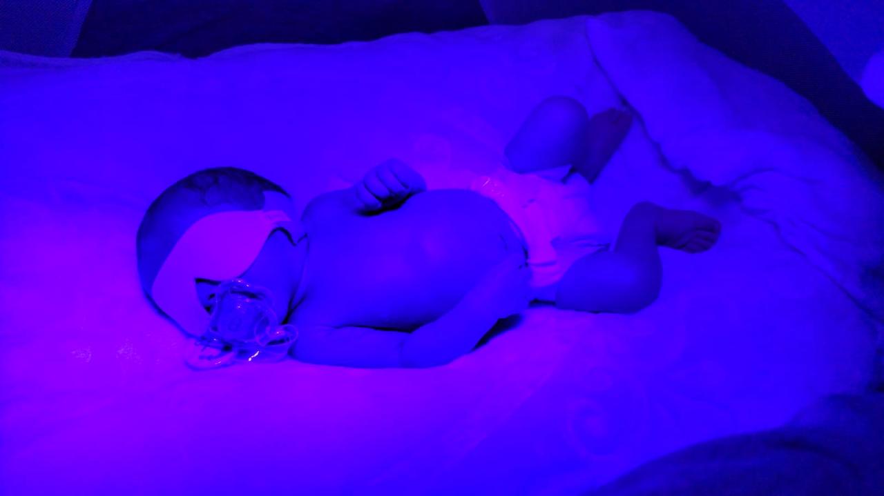 Quando o Bebê Amarelo é Perigoso? Saiba Identificar os Sinais