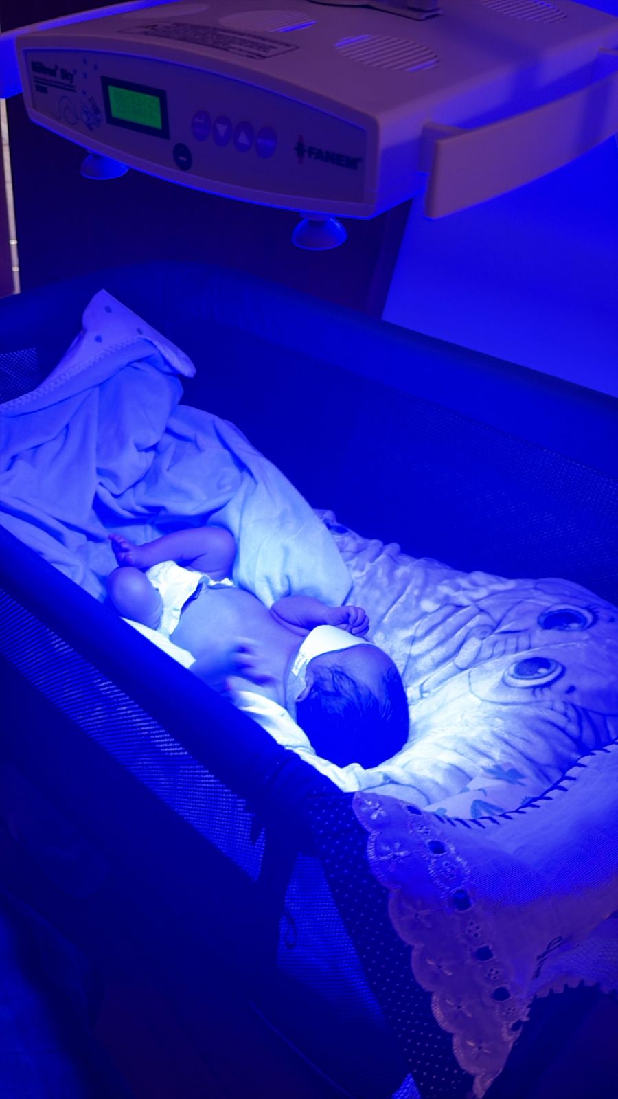 Banho de Luz no ABC: Fototerapia Domiciliar para Icterícia