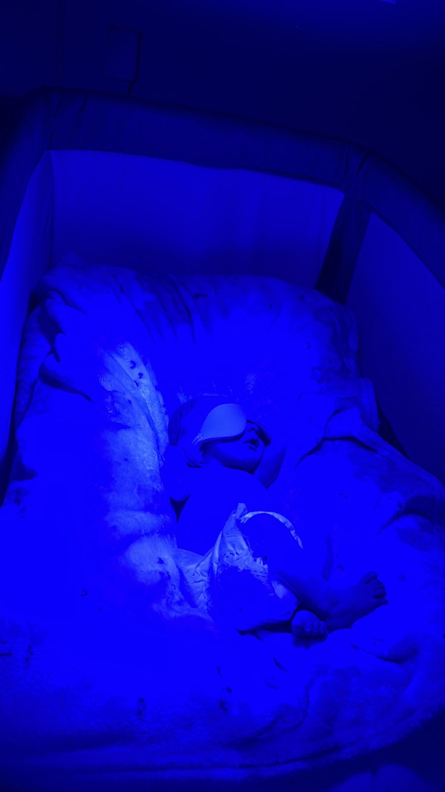 Banho de luz em bebê em São Paulo: quando é indicado