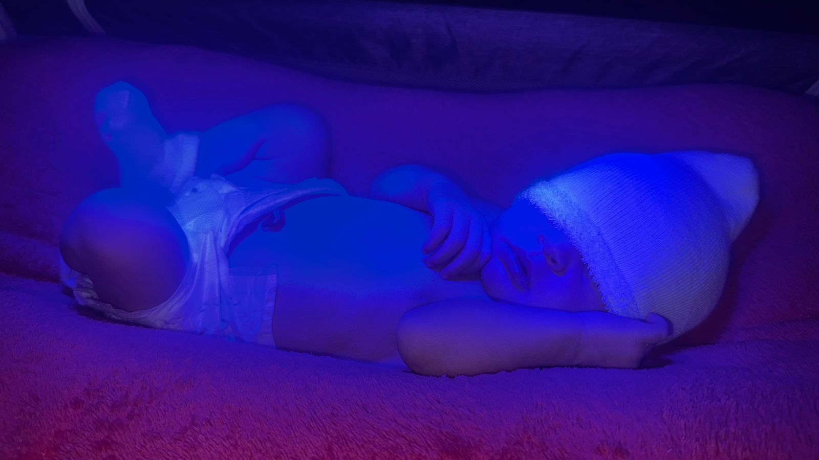 SuperLED Azuis vs Lâmpadas Fluorescentes na Icterícia