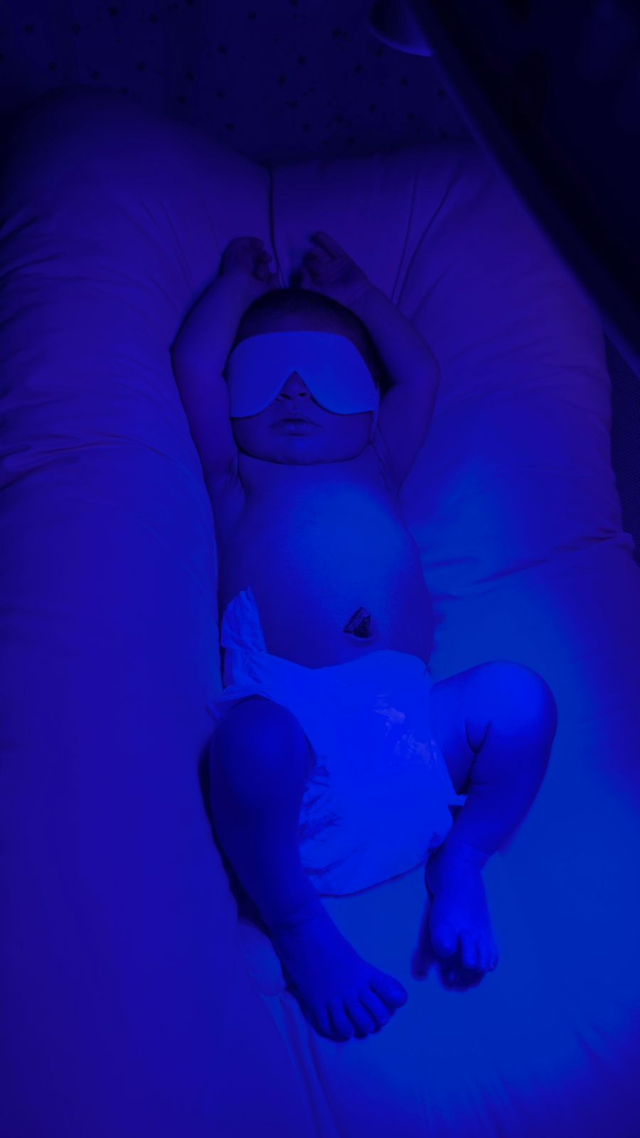Fototerapia Domiciliar em Mauá: Atendimento Rápido sem Separar Mãe e Bebê